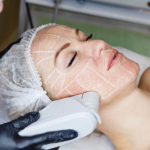 High Intensity focused ultrasound