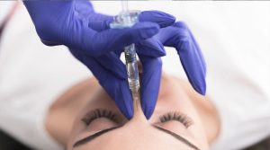 Nose Job-Dermal Filler-Non Surgical Rhinoplasty